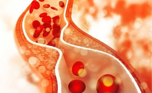 血管内皮|血管堵塞的人,睡觉会有4个表现,若1个不占,血管还很通畅