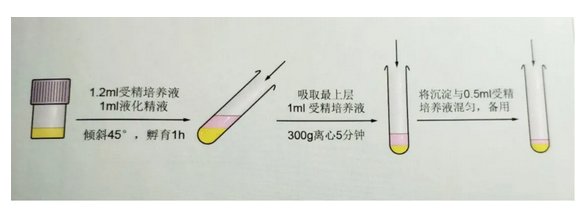 精子|【孕育新生】常用精液处理方法简介
