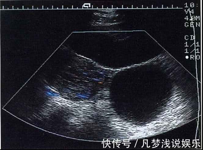 产妇|一次不该有的医疗失误,让产妇多抱了一个孩子出院,责任该谁负?