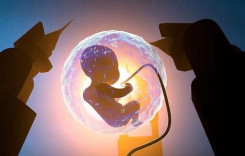 小云|胎儿脐带绕颈的原因有很多，孕妇要提前预防，别等出问题了才后悔