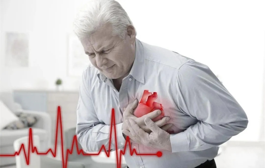 动脉粥样硬化性心血管疾病|动脉粥样硬化的日常防护