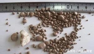 喜欢|辟谣:长肾结石是因为水里面有水垢?其实肾结石更喜欢2类人