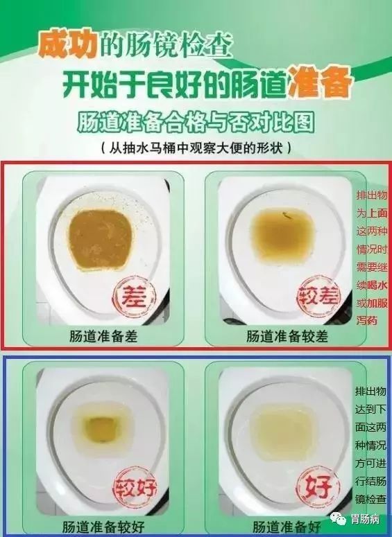 电解质散|肠镜检查前如何清肠，请收下这份最详细的指南