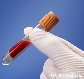 甘油三酯升高|高血脂不能吃什么 日常饮食高血脂不能吃什么