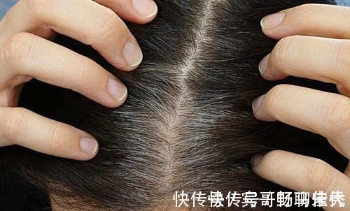 黑眼圈|每晚睡觉前,吃一粒维生素E的人,最后会怎样?4个好处不请自来