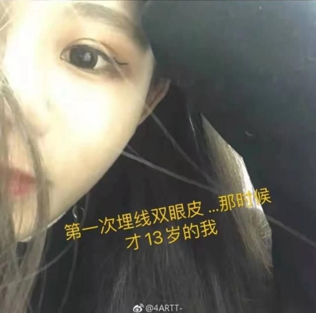 整容|13岁女孩每天被逼跳绳3000个：妈妈的审美焦虑，把她送进了医院