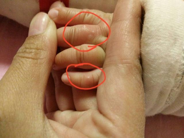 家娃|孩子聪明不聪明,从手上这些特征就能看出,快看看你家娃有吗