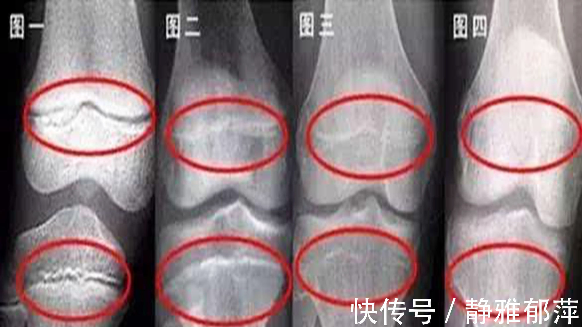 初潮|女孩初潮时间决定了身高发育，科学家：早于这个时间，往往会矮小