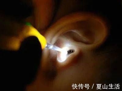 宝宝|宝宝耳朵异物不能忽视,不要耽误最佳的治疗时间