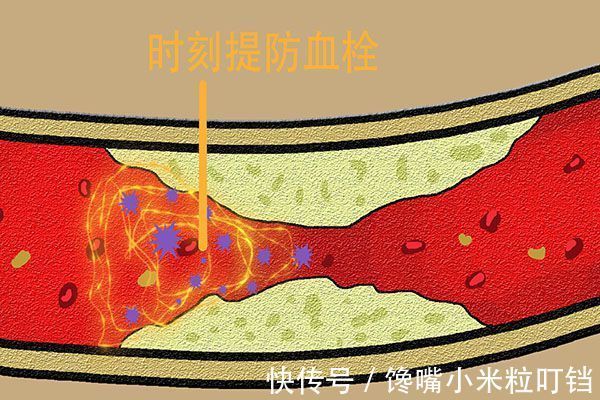 食用|血管堵塞的“祸根”不是肉，世卫组织呼吁停止食用，好多人还在吃