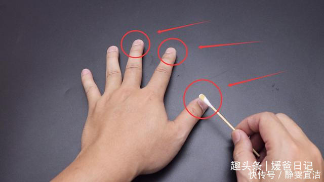 红霉素软膏的5个作用,简单实用,回家找找有没有,试试