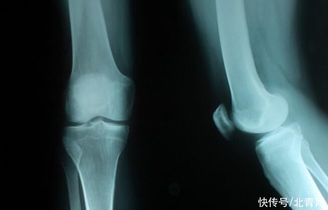 寒性体质|经常吃榴莲的人,身体会出现什么变化?