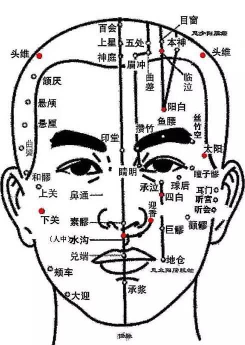  头痛辩证取穴
