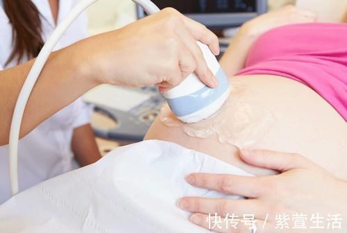胎宝|孕期胎儿是否稳定可以自查?四个征兆要清楚,有一种常被忽视