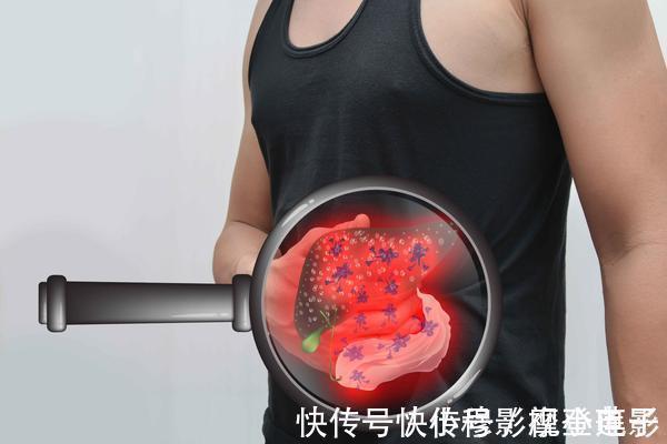 饮水量|肝硬化来临时,通常会有这4种异常,占一个,也要引起注意