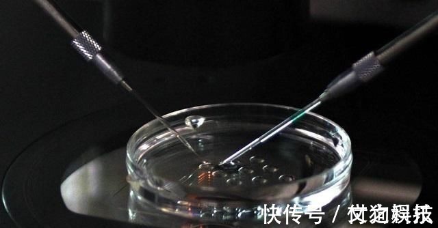 郑女士|国内首例“试管婴儿”,如今已32岁,生活状况在众人意料之外