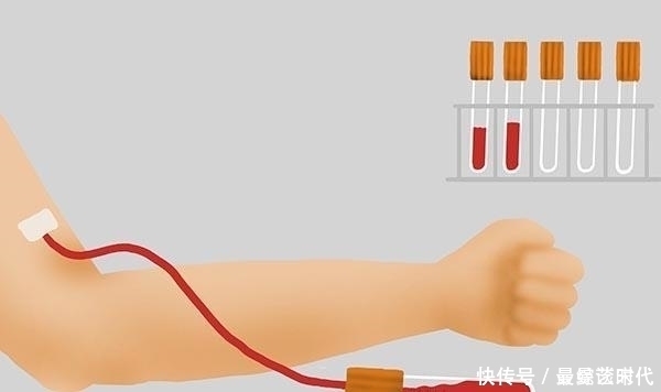 甲狀腺|查出甲狀腺結節,就和海鮮無緣了嗎?醫生:真正要忌口是2種食物