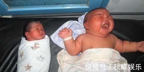 产妇|41岁高龄产妇竟产下17斤巨婴, 巨宝宝胃口更是大得让人咂舌