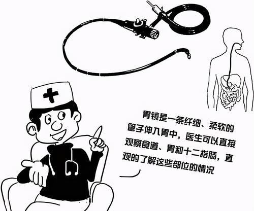 无痛|做胃镜,选普通的,还是无痛的?医生帮你详细分析一下