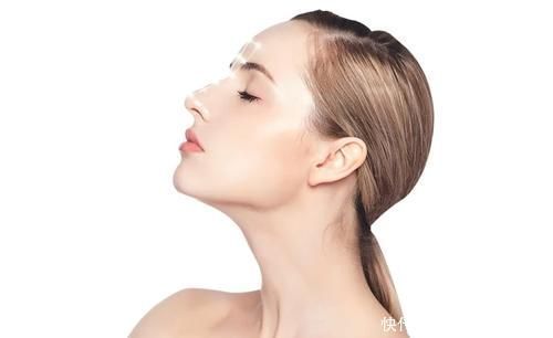 鼻部|隆鼻假体会露吗？鼻梁会塌吗？会留疤吗？注射安全吗？能戴眼镜吗……