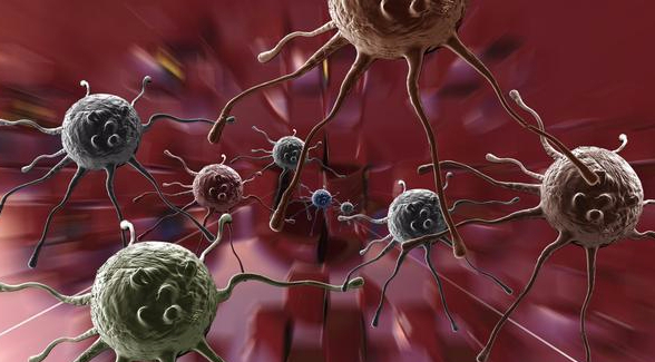 肺结节|体检查出结节、息肉、囊肿,哪个才是癌症前兆帮你做了3个分析