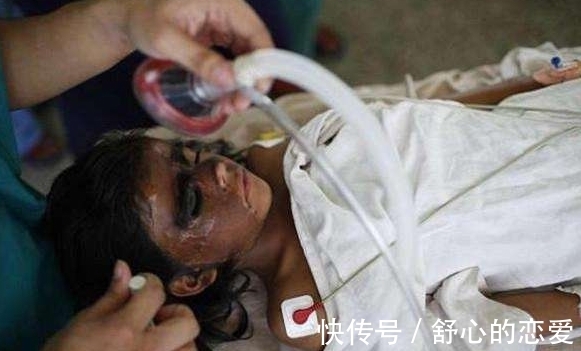 长相|9岁女孩因长相奇怪被称为“半脸怪物”,术后让人大开眼界