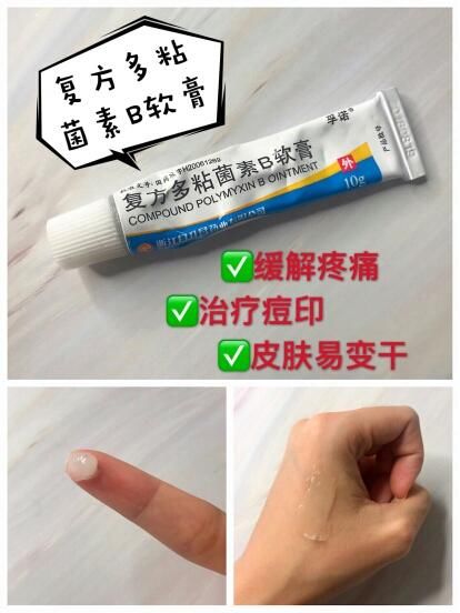 家里必备药膏,小问题再也不用求医了!你买对了吗?