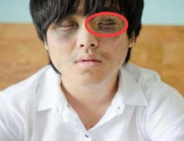 学生党想“越长越漂亮”请避开这“3行为”,拉低颜值可别哭