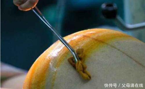 腹部|顺产妈妈分娩后腹部还会有个鼓鼓的硬块是怎么回事