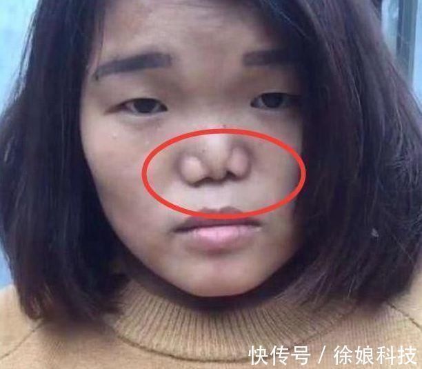 青春期女生“贼伤鼻子”的3行为,自认为很舒服,难怪异性缘为0