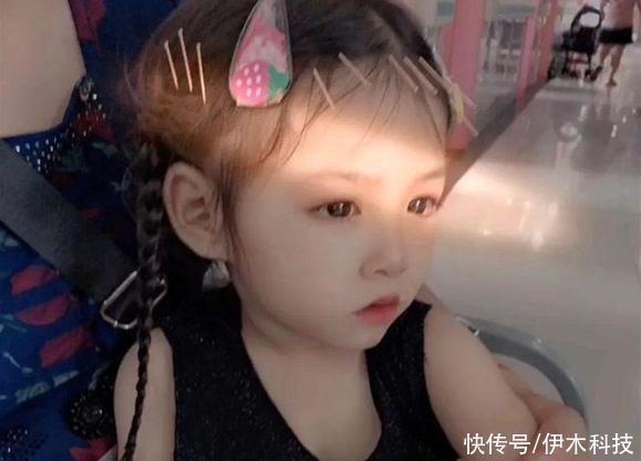 健康|孩子长得“太漂亮”也是病?上帝给了天使的脸,却拿走了她的健康