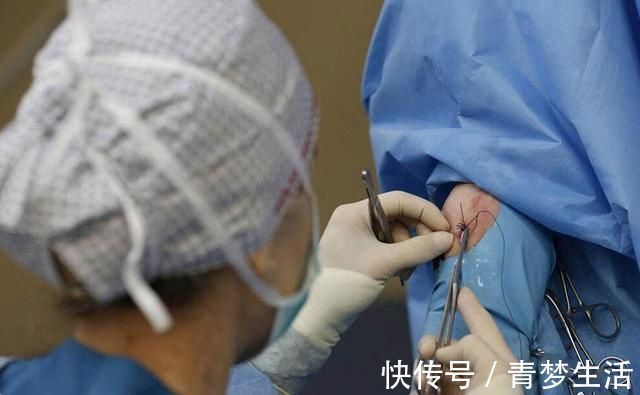 孕妇|同样是被“划一刀”,侧切和剖腹产这7个方面区别大,你很难想到