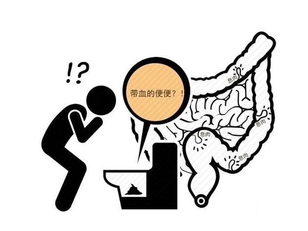 细条样|身体抱恙,大便告知!大便形状变细,警惕4种疾病造访