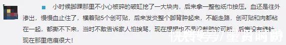 手指|三岁女童被活活截断手指,终生残疾!只因用错创可贴,快自查