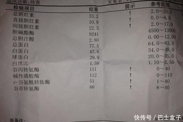 乙肝病毒携带者与病毒和平共处 建议:不喝酒!