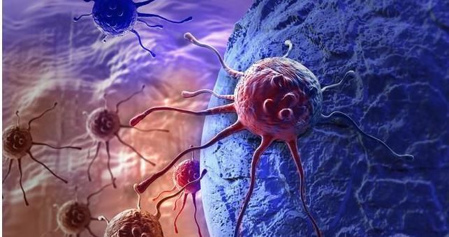 治疗|癌症除了难治疗,还有这4大特性值得了解,建议收藏