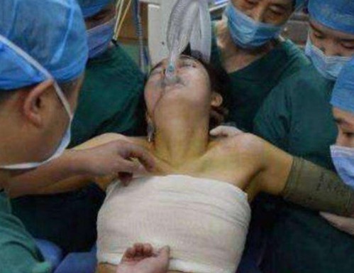 隆胸手术 女子婚前做隆胸手术,医生做全身检查却发现不寻常,报警求助