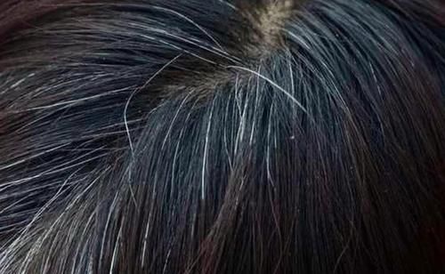 头发|白头发越长越多，怎么办？建议：以下这4点，或对你有益