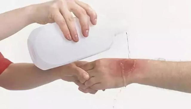 家长|孩子被烫伤后,是先脱衣服还是先冲冷水家长一定要提前知道