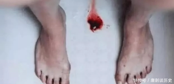 女生来大姨妈,经常排出“红肉团”?多半是“这3原因”,别不当回事!