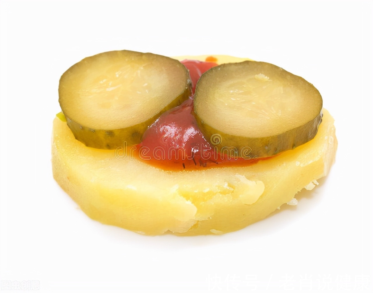 油脂|奖门人:7种食物是升血脂高手!有人从血液里“滤”出了2升油浆,你还吃得津津有味?