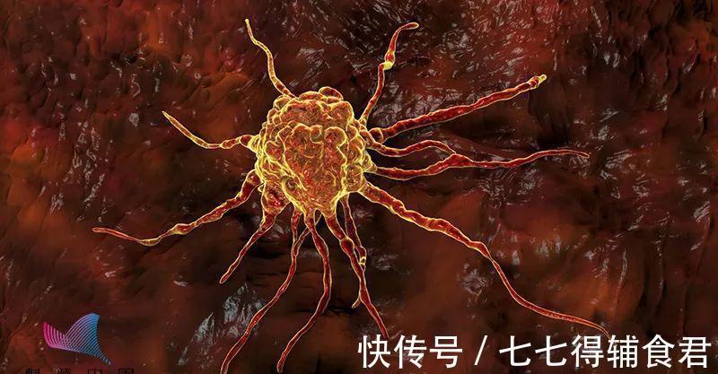 酒精|去年超74万人因它患癌,居然还有人用它来养生!劝你不碰为好