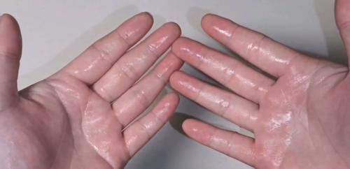 赶紧把白醋倒在手心搓一搓,真的太厉害了,活了20年才知道!