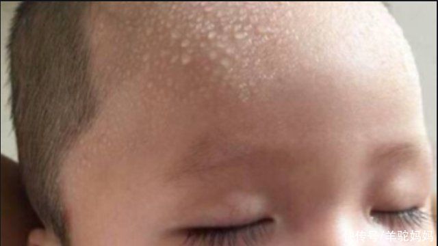 饮食|“脾胃虚”的宝宝，身上这2个部位经常出汗，父母早了解娃早受益