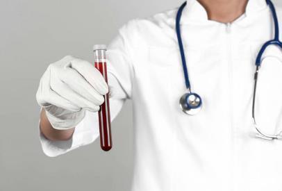 正常值|体检发现癌胚抗原升高,是怎么会事,是大肠癌吗三类人最好检查