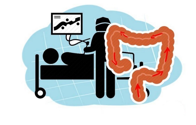 中老年人|年级越大,癌症越易找上门!4种癌症筛查,劝中老年人别错过!