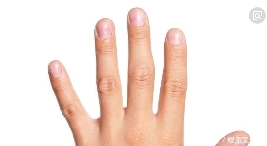 指甲上出现“竖纹”别自己瞎猜了,3个原因才是“元凶”