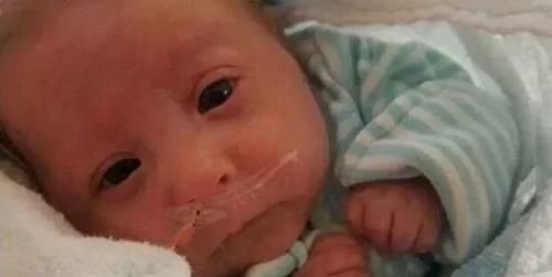 侏儒症|婴儿刚出生就被判侏儒症停止发育,父母不愿放弃如今变成这样!