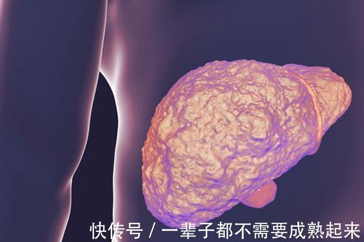 排毒|此物被称为“肝脏化毒王”,没事吃两口,肝硬化会自动退却!