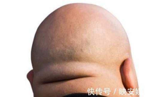 小知识|“短命”的人,通常都有5个共性,若1个不占,或许与长寿有缘!